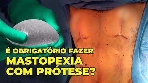 mastopexia com protease